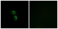 ARMC6 Polyclonal Antibody