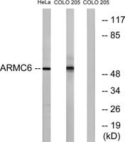 ARMC6 Polyclonal Antibody