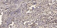 ARMCX1 Polyclonal Antibody