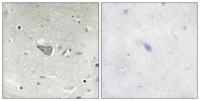 ARMCX3 Polyclonal Antibody