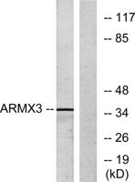 ARMCX3 Polyclonal Antibody