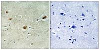 Arnt 2 Polyclonal Antibody
