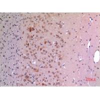 GDF-5 Polyclonal Antibody