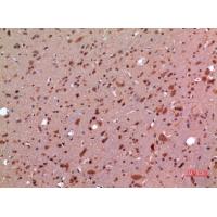 GDF-5 Polyclonal Antibody