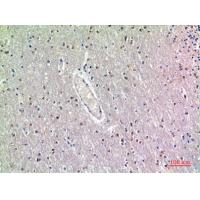GDF-7 Polyclonal Antibody