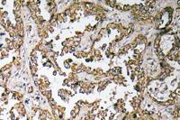 GDF-8 Polyclonal Antibody