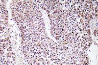 GDF-9 Polyclonal Antibody