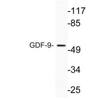 GDF-9 Polyclonal Antibody