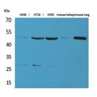 GDI-2 Polyclonal Antibody