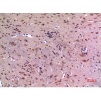 GDI-2 Polyclonal Antibody