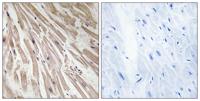 ARPP-21 Polyclonal Antibody