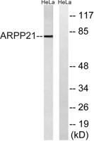 ARPP-21 Polyclonal Antibody