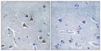 ARRDC2 Polyclonal Antibody