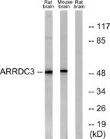 ARRDC3 Polyclonal Antibody