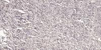 ARRDC3 Polyclonal Antibody