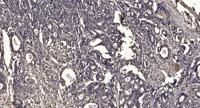 Arrdc4 Polyclonal Antibody