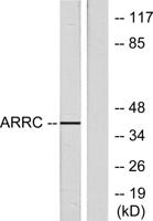 Arrestin-C Polyclonal Antibody