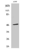 Arrestin-β-1 Polyclonal Antibody