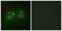 Arrestin-β-1 Polyclonal Antibody