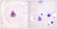 Arrestin-β-1 Polyclonal Antibody