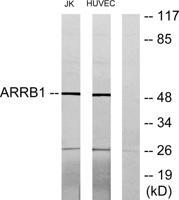 Arrestin-β-1 Polyclonal Antibody