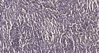 Arrestin-β-1 Polyclonal Antibody