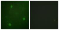 Artemis Polyclonal Antibody