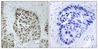 Artemis Polyclonal Antibody