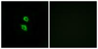 Arylsulfatase D Polyclonal Antibody