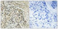 Arylsulfatase D Polyclonal Antibody
