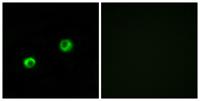 Arylsulfatase I Polyclonal Antibody