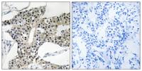 Arylsulfatase K Polyclonal Antibody