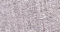 AR-α1A Polyclonal Antibody