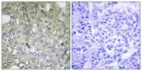 AR-α1D Polyclonal Antibody