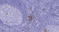 AR-β1 Polyclonal Antibody