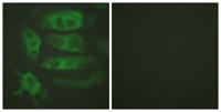 AR-β2 Polyclonal Antibody
