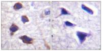 AR-β2 Polyclonal Antibody