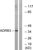 AR-β3 Polyclonal Antibody