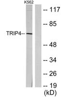ASC-1 Polyclonal Antibody