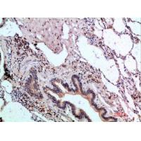 ASCL1 Polyclonal Antibody