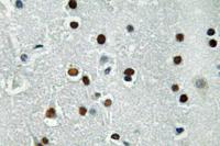 ASCL1 Polyclonal Antibody