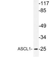 ASCL1 Polyclonal Antibody