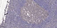 ASF1B Polyclonal Antibody