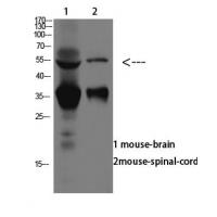 ASIC1 Polyclonal Antibody