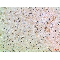 ASIC1 Polyclonal Antibody