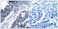 ASK 1 Polyclonal Antibody