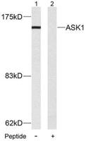 ASK 1 Polyclonal Antibody