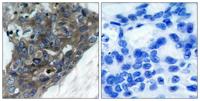 ASK 1 Polyclonal Antibody
