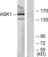 ASK 1 Polyclonal Antibody
