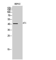AT1 Polyclonal Antibody